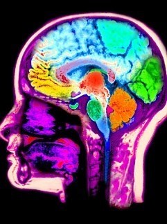 电击刺激大脑可提升学习能力 副作用仍未知