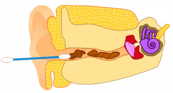 医生都叫别掏耳朵!真的不怕耳屎堵住吗?我看过视频