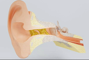 医生都叫别掏耳朵!真的不怕耳屎堵住吗?我看过视频