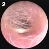 医生都叫别掏耳朵!真的不怕耳屎堵住吗?我看过视频