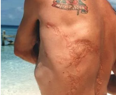 日本海豚攻击游客致18人受伤 疑一头雄鲸作案:太无聊闲的!