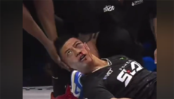 中国通背拳传人赵鸿刚参加世界职业扇耳光大赛遭KO：眉骨缝5针 本人回应：没有脑震荡