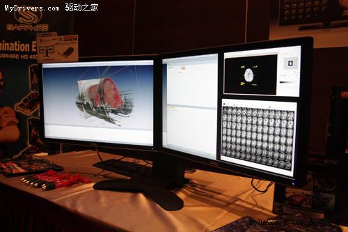 肿瘤早期发现 放射医学诊断等不可缺少的专业呈现利器--蓝宝科技ATI FirePro专业医疗显示卡