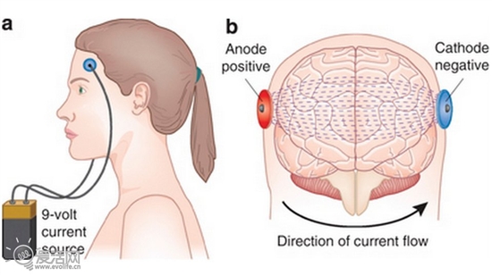 新研究：适度电击大脑能有效提高智商