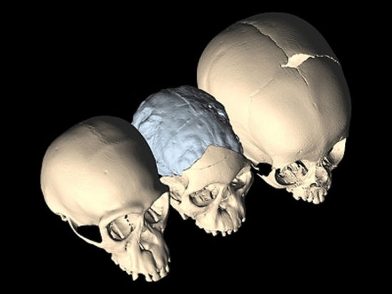 研究表明“分娩困境”已困扰人类数百万年