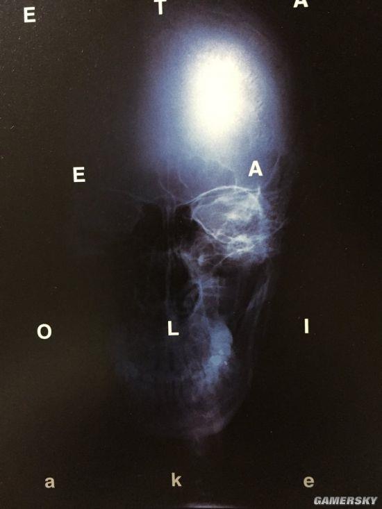 С�����ͷ�ǹǳ�ɶ�������Ȿ14��ǰ����