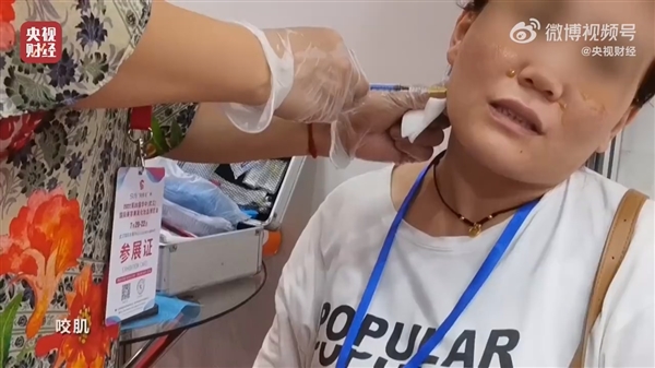 央视315曝光不可注射的美容针：10倍利润 或致毁容