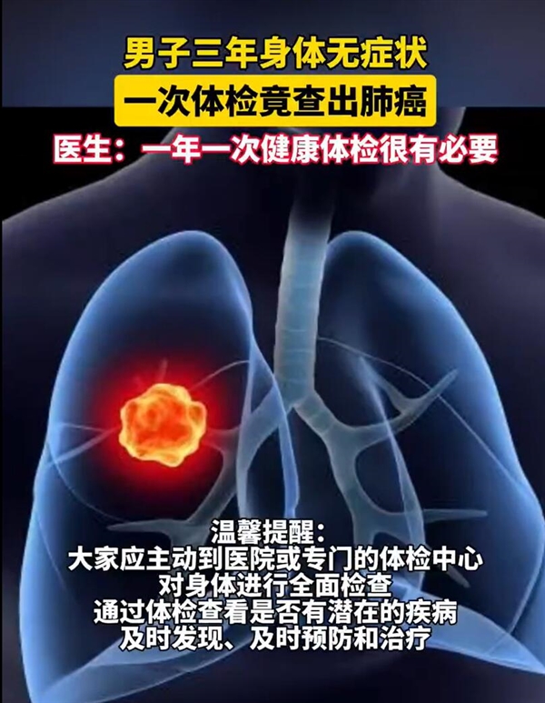 男子3年身体无症状：一次体检查出肺癌