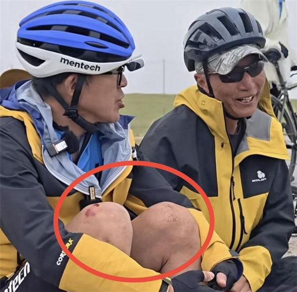 俞敏洪骑车摔倒深夜发博：感谢关心 皮外伤